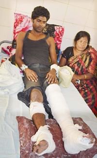 Charghat JCD leader Rocky Hossain undergoes treatment at Rajshahi Medical College Hospital. Tendons of his legs and of a hand were severed allegedly by the activists of Awami League on Sunday night as a sequel to a clash centring the March 15 upazila polls. Photo: Star