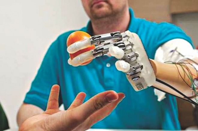 First Bionic Hand That Can Feel | The Daily Star