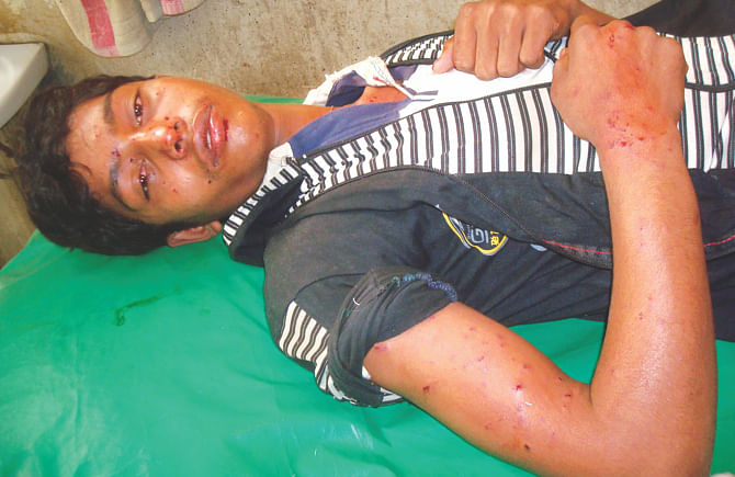 Another helper injured by cocktails hurled at his truck in Chapainawabganj, despite a law enforcement escort. Photo: Star, Banglar Chokh