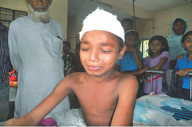 Torture victim Shimul, now undergoing treatment at Aditmari Upazila Health Complex in Lalmonirhat district, breaks down in tears as he narrates his torment to The Daily Star correspondent yesterday.  PHOTO: STAR