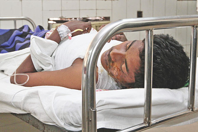 Chouddagram arson victims being treated at Dhaka Medical College and Hospital. Photo: Anisur Rahman/Collected
