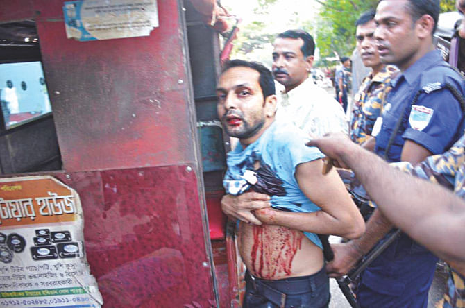 Kamal heavily bleeds as he is being taken to a local hospital under police custody in Jessore on Wednesday.   Photo: Courtesy 