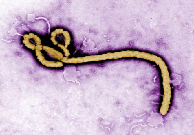 Some of the ultrastructural morphology displayed by an Ebola virus virion is revealed in this undated handout colorized transmission electron micrograph (TEM) obtained by Reuters August 1, 2014. Photo: Reuters