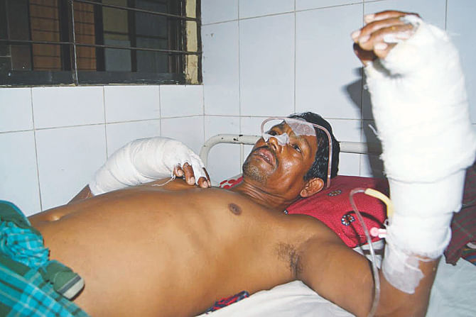 Fazlur Rahman, a rickshaw-puller, being treated for burns in Chittagong Medical College Hospital yesterday. He came under a bomb attack in Colonel Haat area of the port city on Friday night, allegedly by a blockader. Doctors said about 35 percent of his body had been affected. Photo: Star