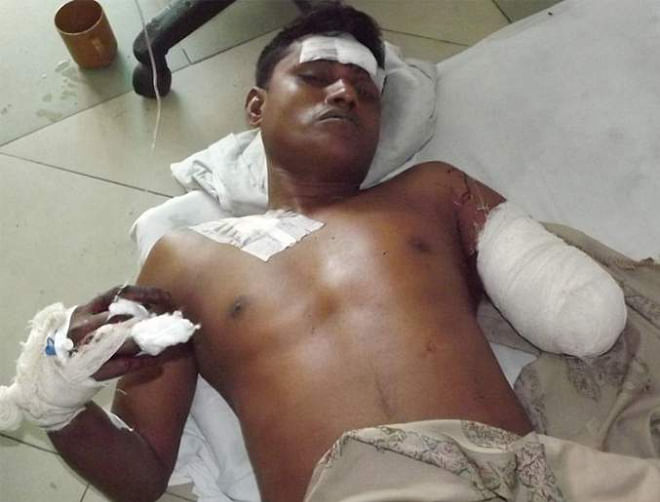 His hand severed, illegal sand lifter Moshiur Rahman undergoing treatment at Ziaur Rahman Medical College Hospital in Bogra. PHOTO: STAR