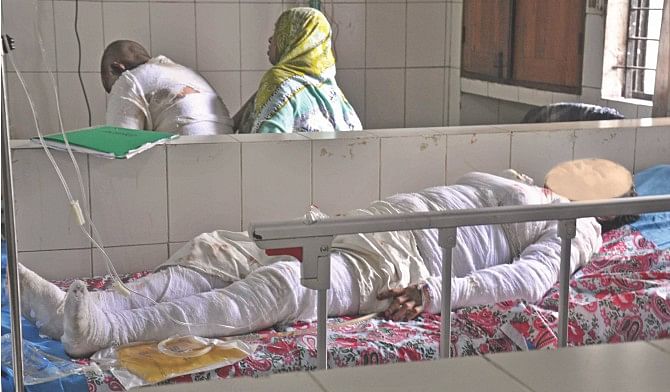 Rahima Begum, 50, who was burnt with four of her children in a fire at their house in Keraniganj early yesterday, lying in bed at Dhaka Medical College Hospital before she lost her battle for life last evening. She had suffered 90 percent burns, while the four were agonising with injuries over 17-35 percent of their bodies. The victim's face was blurred because the wound was too gory to be seen.  Photo: Courtesy 