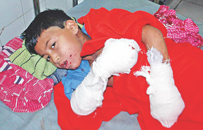 Schoolboy Fahim in a bed of Dhaka Medical College Hospital on January 6, 2014. He was injured when a homemade bomb went off in Badda in the capital during a hartal. Photo: File