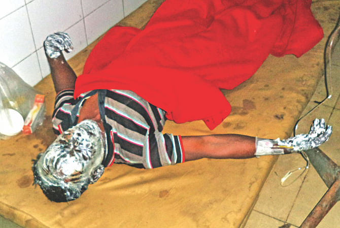 He had nothing to do with politics. Yet violent politics has cost trucker Rafiqul Islam dearly as he suffers agonising pain from burn wounds at Dinajpur Medical College Hospital yesterday. Criminals on Wednesday night hurled a petrol bomb at his truck on the Dinajpur-Thakurgaon highway at Bhatgaon village of Kaharol upazila, Dinajpur, that left two others injured. Photo: Star