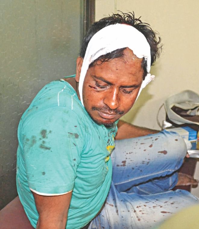 Channel 24 cameraperson Raihanul Haque, who were injured during the interns' assault on them at the hospital Sunday night. Photo: Star
