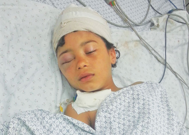 Nine-year-old Mariam, a victim of Israeli air strike on Gaza, lies in intensive care at a hospital in Palestine. Photo: Independent.co.uk
