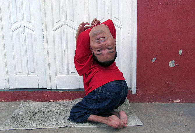 Resourceful: Claudio Vieira de Oliveira has a rare degenerative disease of the joints that has left him without the use of his limbs ... and an upside-down head. Photo taken from Barcroft media