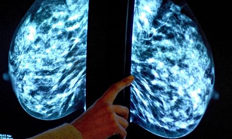 In future a simple blood test may indicate whether a woman is at higher risk of developing breast cancer and help her decide if she wants tailored breast mammograms like the one above or other options. Photograph: Rui Vieira/PA