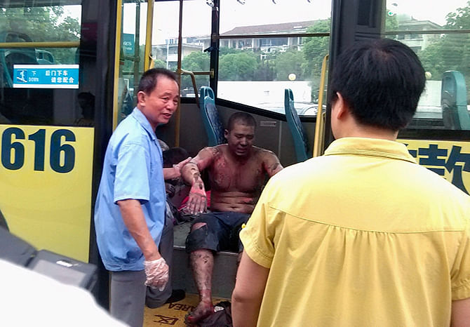 Rescuers help an injured man get off a bus, near a hospital, after an explosion at a factory in Kunshan, Jiangsu province August 2, 2014. The factory blast in China's eastern industrial province of Jiangsu has killed at least 65 people and injured more than 100 others, Chinese state media said on Saturday, citing government sources. Photo: Reuters