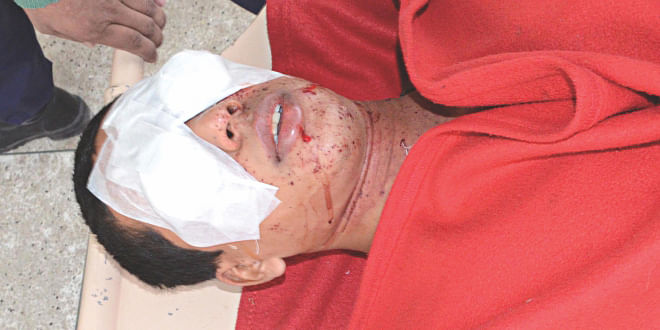 Constable Towhid with injuries to his eyes at Rajshahi Medical College Hospital. Policemen were among the nine injured when alleged BNP-Jamaat men hurled homemade bombs inside a police van in Sonadighi of Rajshahi yesterday. Siddhartha was later flown to Combined Military Hospital in Dhaka but he died last night.