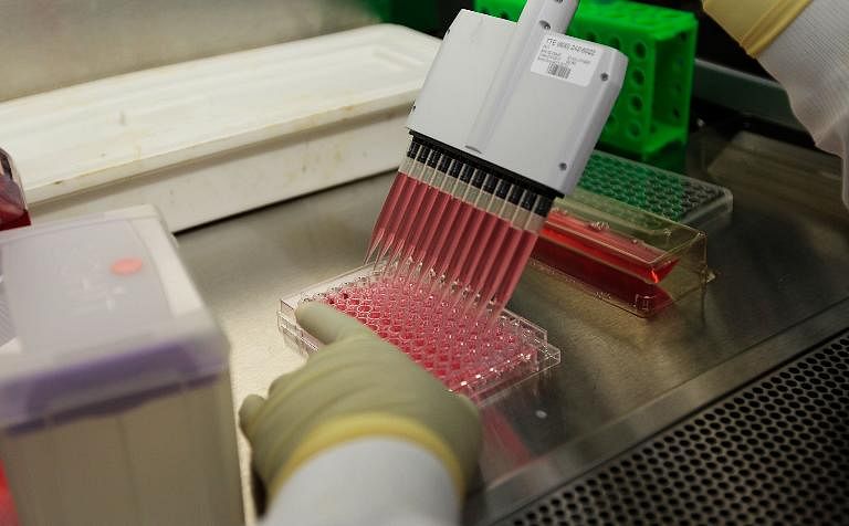 A researcher at the International AIDS Vaccine Initiative laboratory works on samples at the lab in New York. Photo: AFP