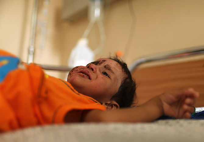 Palestinian boy Mohammed Wahdan, whom medics said was wounded in Israeli shelling, lies on a bed as he receives psychological care at Shifa hospital in Gaza City August 14, 2014. Photo: Reuters