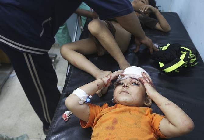 A Palestinian girl, whom medics said was wounded in an Israeli air strike, lies on a bed as she receives treatment at a hospital in Khan Younis in the southern Gaza Strip August 8, 2014. Photo: Reuters