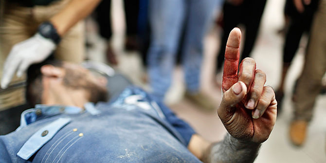 A Palestinian man, who medics said was wounded by Israeli shelling, raises his finger as he is brought to a hospital in Gaza City July 23, 2014. Israeli forces pounded multiple sites across the Gaza Strip on Wednesday, including the enclave's sole power plant, and said it was meeting stiff resistance from Hamas Islamists, as diplomats sought to end the bloodshed. Photo: Reuters