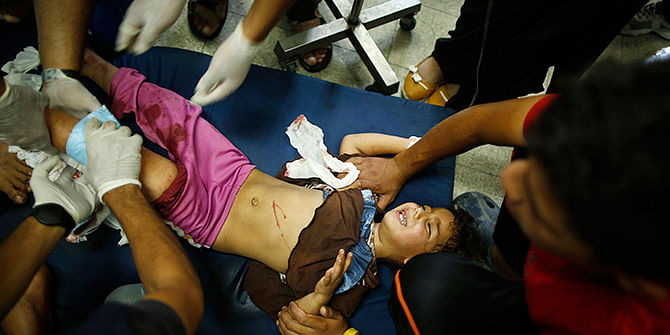 A Palestinian girl, whom medics said was wounded in Israeli shelling at a U.N-run school sheltering Palestinian refugees, is treated at a hospital in the northern Gaza Strip July 24. Photo: Reuters 