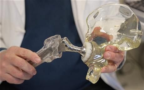 In this AP photo taken on March 5, 2014, Dr. Joshua Jacobs, orthopedics surgery chief at Rush University Medical Center and president of the American Academy of Orthopaedic Surgeons in Chicago, holds a model of a cementless hip replacement. 