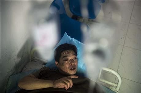 In this photo released by China's Xinhua News Agency, miner Duan Xukang receives a treatment at a hospital in Fukang City, northwest China's Xinjiang Uygur Autonomous Region, after being rescued following a gas explosion at a coal mine in western China, Sunday, July 6, 2014. This photo taken from AP website. 