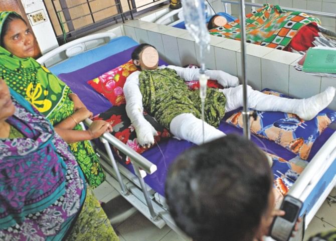 Popy Akter, 17, her mother Selina, 40, and brother Anik, 12, are fighting for their lives at the burn unit of Dhaka Medical College Hospital. Popy and Selina's faces have been hidden to spare readers from the gory wounds. Photo: STAR 
