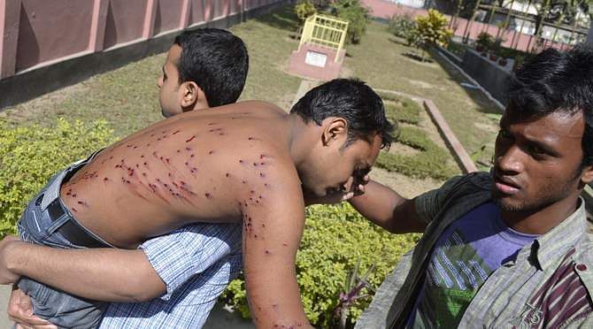 In this February 2 photo, two students of Rajshahi University take their fellow who sustains injuries during police firing at a demonstration of the students. Photo: STAR    