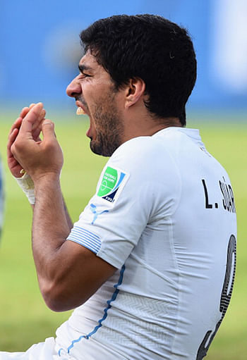  Luis Suarez of Uruguay reacts after a clash during the 2014 FIFA World Cup Brazil Group D match between Italy and Uruguay at Estadio das Dunas on June 24, 2014 in Natal, Brazil. Photo: Getty Images 