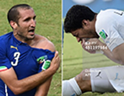 This combo of 2 photos shows Italy's defender Giorgio Chiellini (L) showing an apparent bitemark and Uruguay forward Luis Suarez (R) holding his teeth after the incident during the Group D football match between Italy and Uruguay at the Dunas Arena in Natal during the 2014 FIFA World Cup on June 24. Photo: AFP/Getty Images