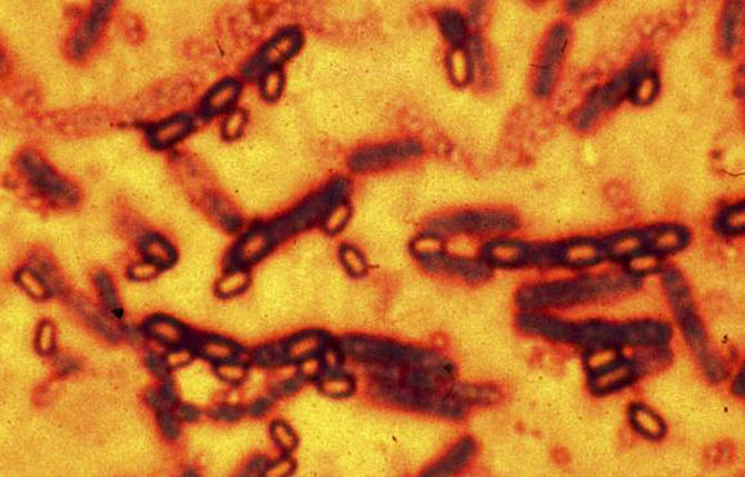 A microscopic picture of spores and vegetative cells of Bacillus anthracis which causes the disease anthrax is pictured in this undated file photograph. Photo: Reuters
